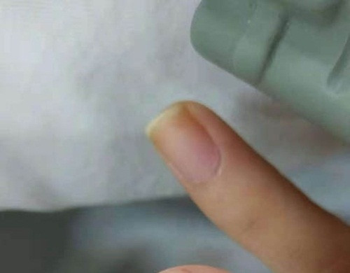 Trai tre de cap nong cuc doc can tu tu va ket gay soc