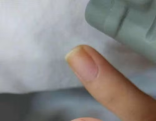 Trai tre de cap nong cuc doc can tu tu va ket gay soc