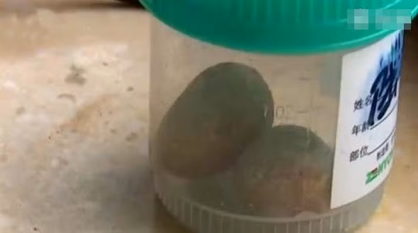 An chay truong ma thieu... nguoi phu nu gap chuyen ai cung khiep