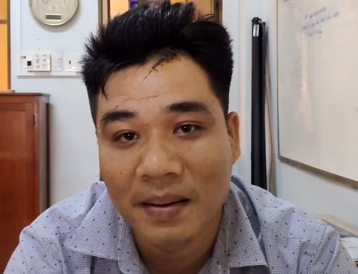 Nho mua ma tuy khong duoc, hung hang dam chet ban