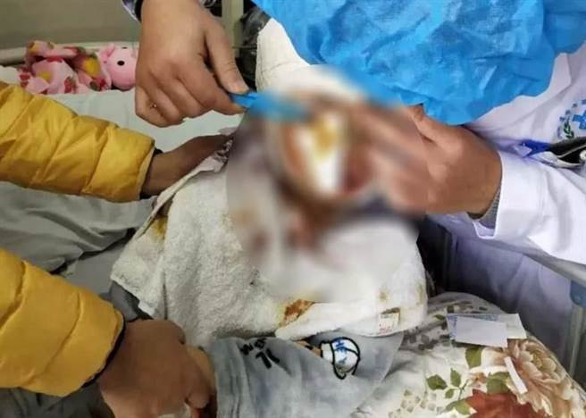 Kinh hoang be 8 tuoi bi cho can xe, lan lon tren dat-Hinh-2