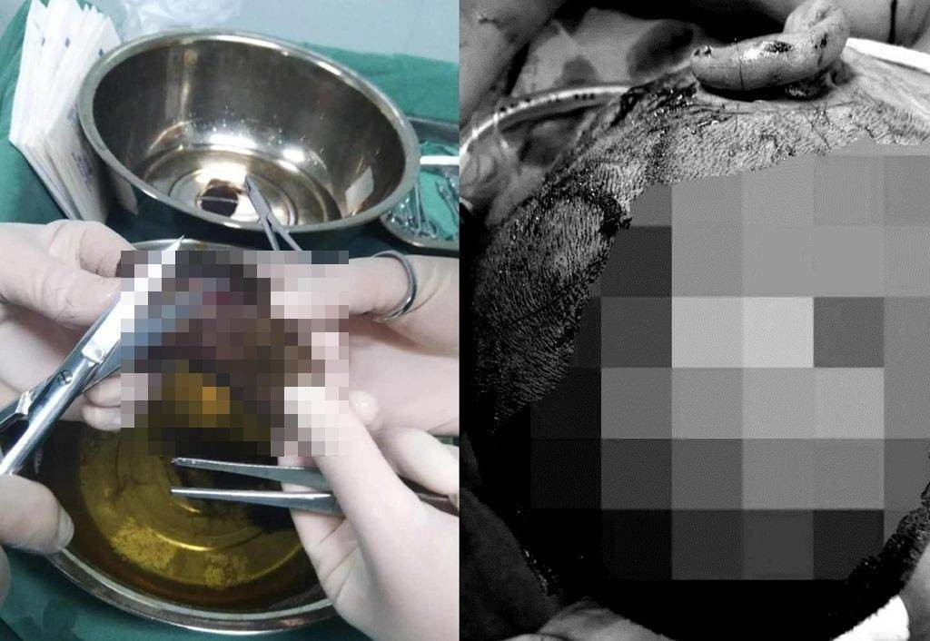 Cho hoang can khap dau mat be trai, 10 vet ruom mau kinh di...