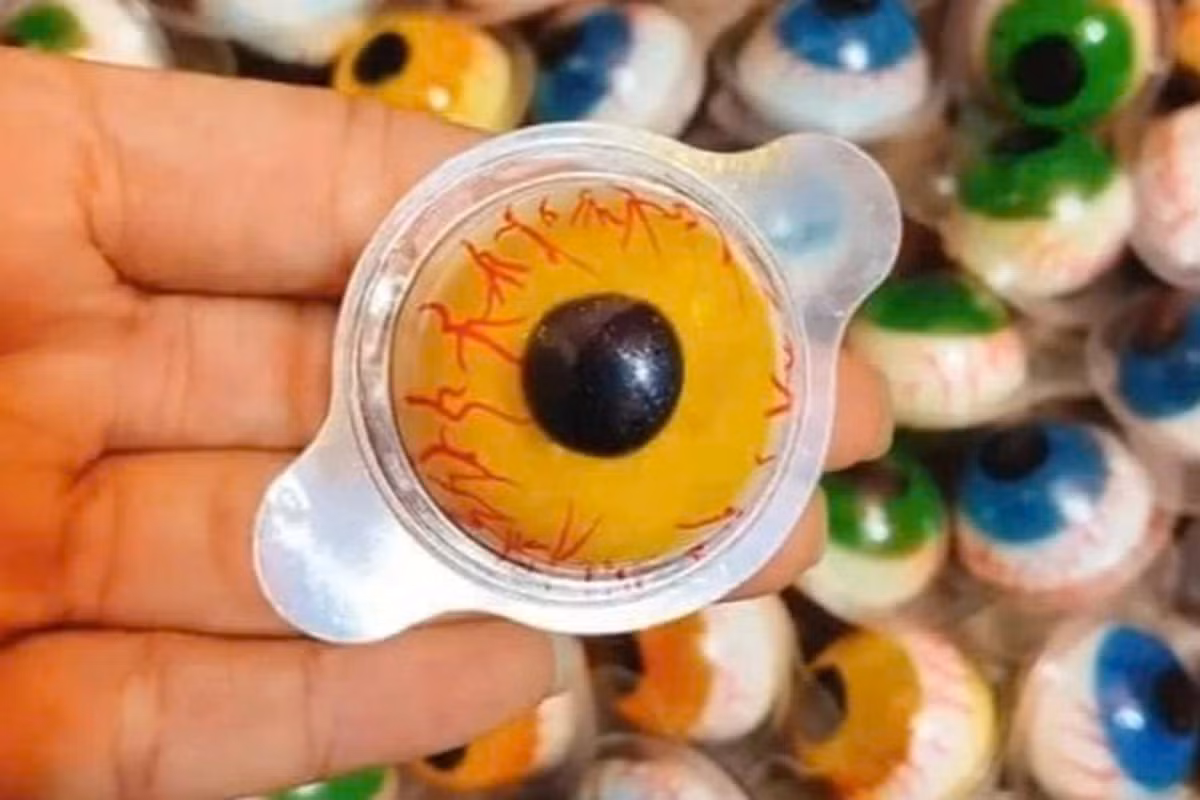 Be trai 3 tuoi tu vong thuong tam do hoc keo hinh con mat