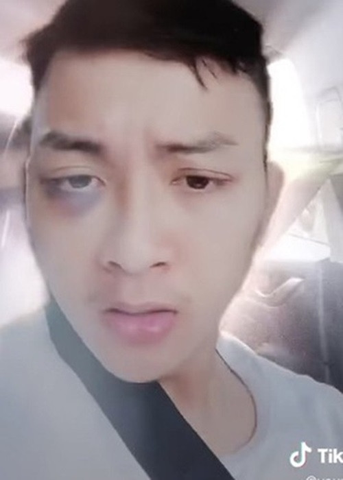 Hậu ly hôn, Hoài Lâm tiếp tục sống ở quê nhà Vĩnh Long. Anh từng gây xôn xao khi lộ hình ảnh tím bầm một bên mắt. Quản lý của Hoài Lâm khẳng định vết bầm là do trong lúc đá bóng, Hoài Lâm vô tình bay lên và va trúng tay người bạn.