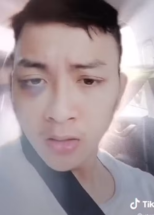 Hậu ly hôn, Hoài Lâm tiếp tục sống ở quê nhà Vĩnh Long. Anh từng gây xôn xao khi lộ hình ảnh tím bầm một bên mắt. Quản lý của Hoài Lâm khẳng định vết bầm là do trong lúc đá bóng, Hoài Lâm vô tình bay lên và va trúng tay người bạn.