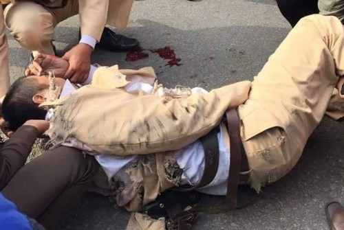 TPHCM: CSGT bi tong trong thuong tren dai lo Pham Van Dong