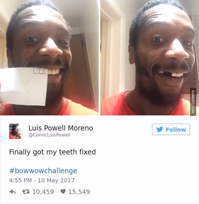 Bị sún răng ư? Quá dễ.