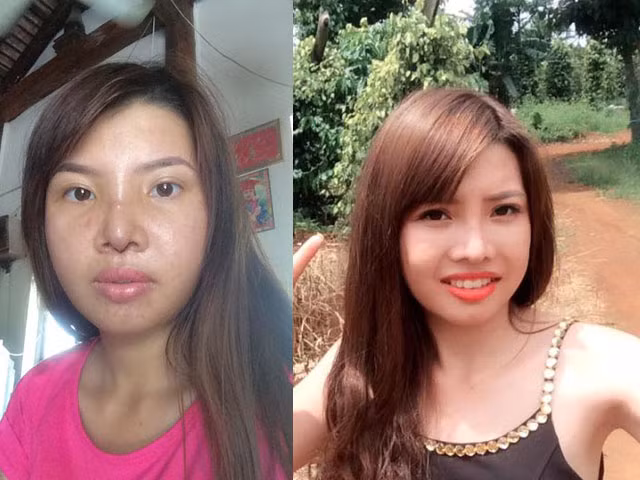 Trước Tùng Sơn, có một cô gái từng được ví với Thị Nở cũng đã chi 200 triệu để làm đẹp.