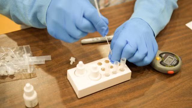 COVID-19: Bien chung MU khang vac xin, su that tu chuyen gia?-Hinh-2