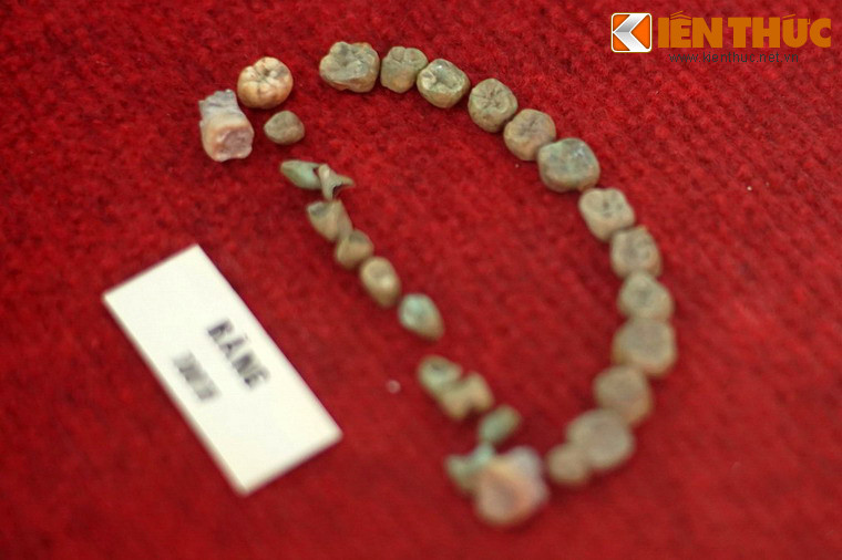 Theo cố giáo sư Trần Quốc Vượng, chủ nhân của khu mộ táng Đại Làng là người Châu Mạ (người Mạ), và từng tồn tại một vương quốc Châu Mạ xưa ở khu vực bao quanh di chỉ. Ảnh: Mẫu răng người được thu thập ở mộ táng Đại Làng.