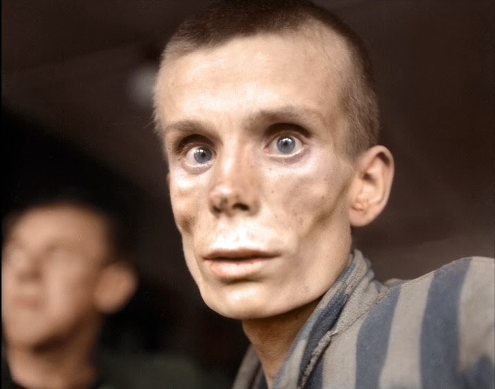 Cô gái Nga 18 tuổi được giải thoát khỏi trại Dachau của Đức Quốc xã, tháng 4/1945. Ảnh: Imgur.