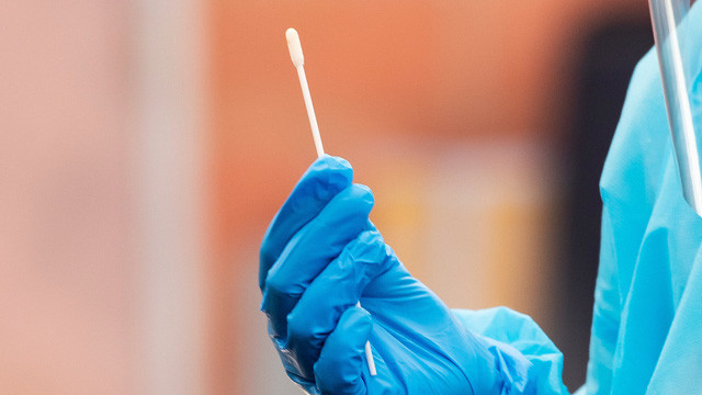 Co phai nguoi tre tuoi nhiem bien the Delta tro benh nhanh hon?-Hinh-2