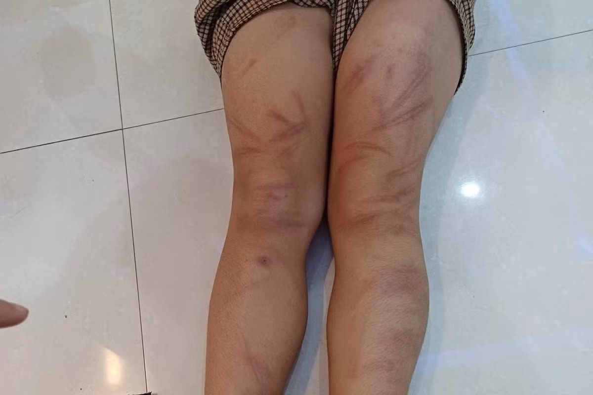 Xac minh vu viec nhieu be mam non bi ban danh bam tim-Hinh-2