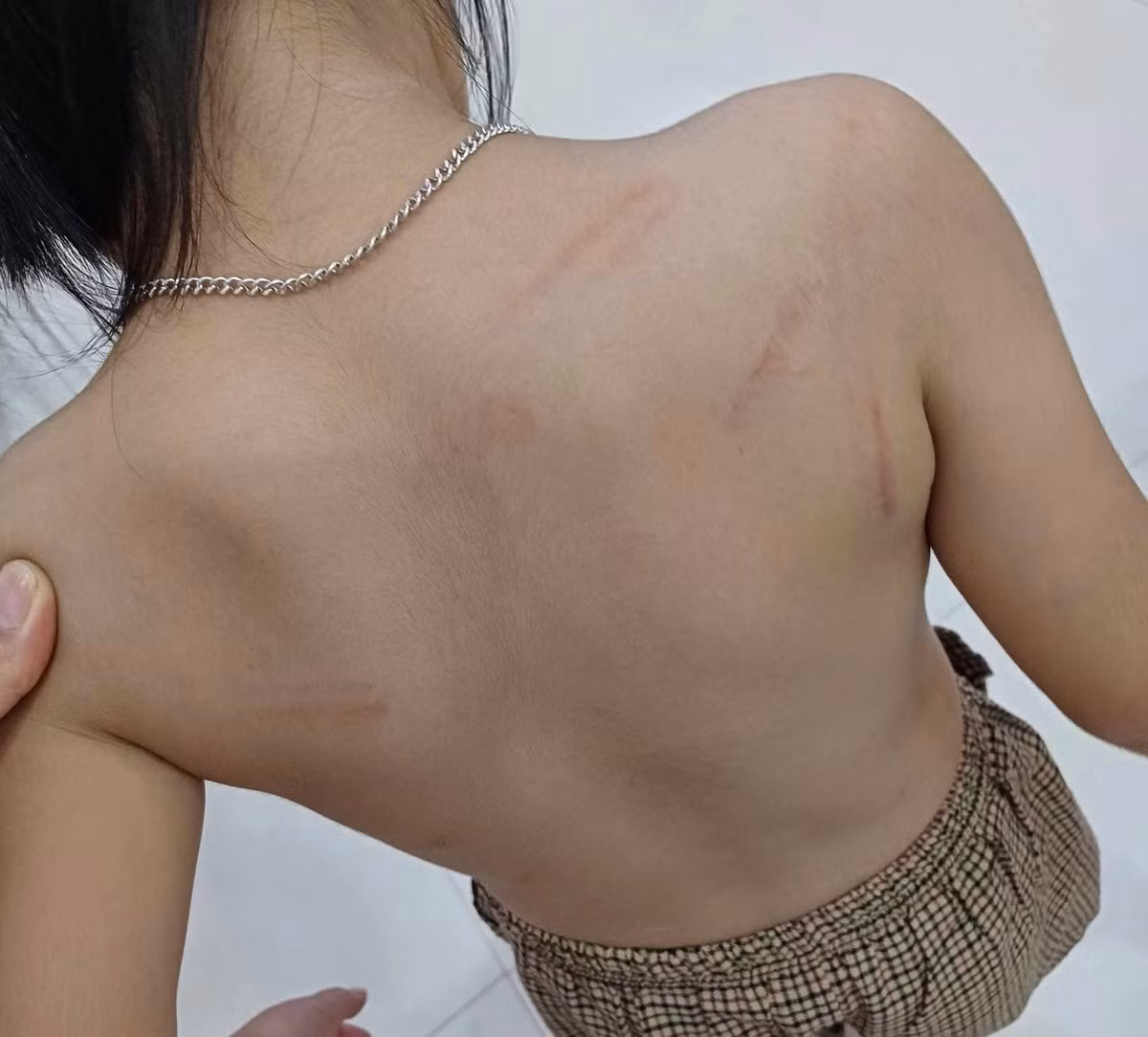 Xac minh vu viec nhieu be mam non bi ban danh bam tim