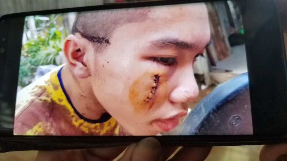 Su that quan he giua thieu nu 22 tuoi voi su o Tinh that Bong Lai?