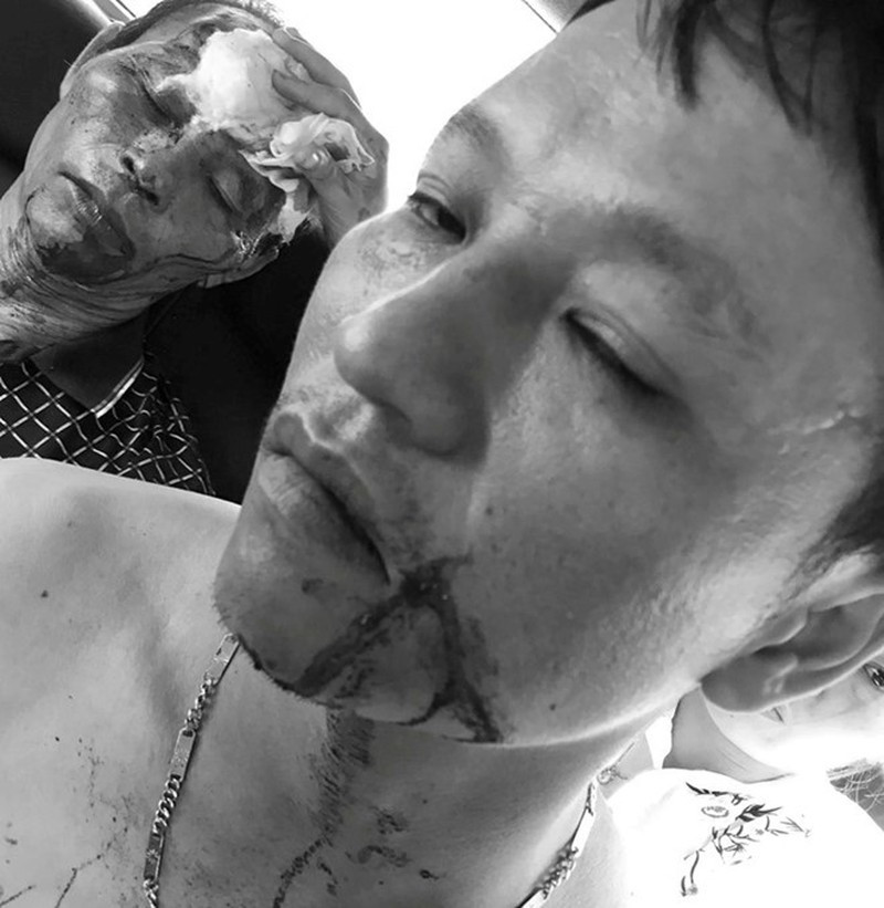 Nhom con do no sung truy sat ca nha o Sam Son: Nguyen nhan la gi?