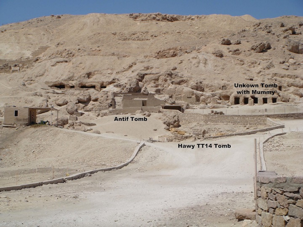 Những người thân đã chăm sóc và giúp cô sống thêm nhiều năm trước khi qua đời, mà tình trạng co gập không cứu vãn được có thể là bằng chứng.