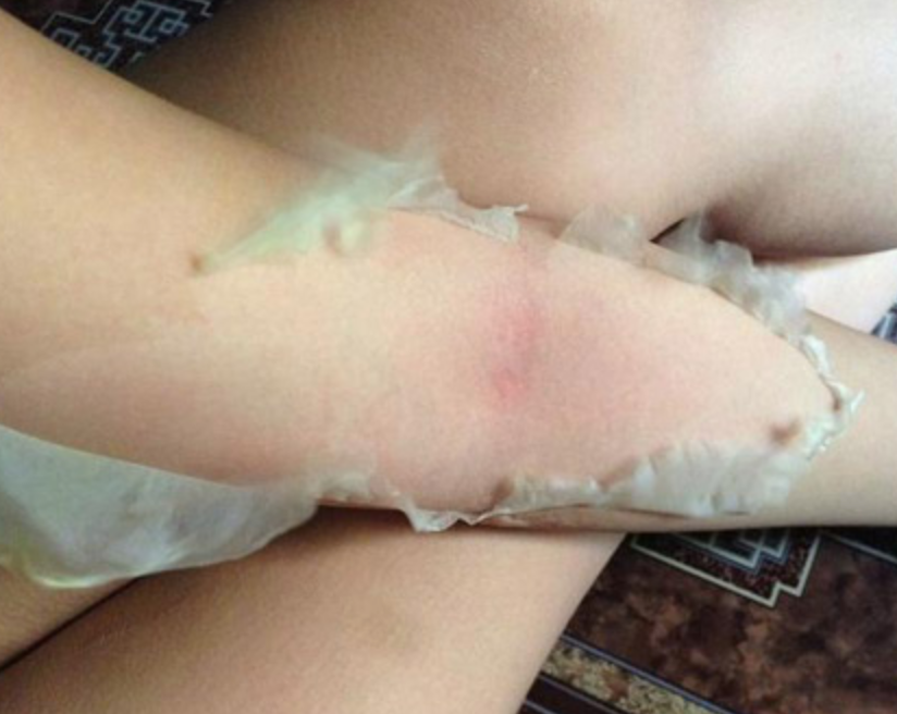 Trào lưu làm đẹp đôi bàn chân này hiện tại đang được nhiều chị em thực hiện và quay clip Tik Tok như một niềm đam mê. Bên cạnh những người hưởng ứng, có không ít dân mạng lại cho rằng đây là hành động phản cảm, kinh dị, không phải là trào lưu dành cho những người yếu tim.