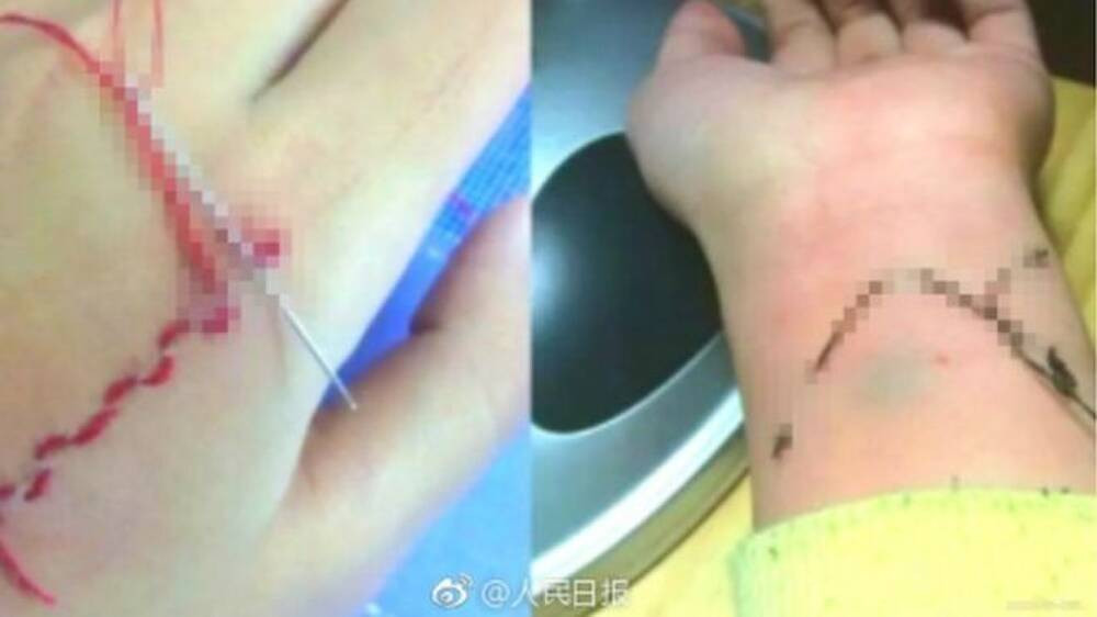 Được biết, trào lưu này bắt nguồn từ nhân vật Juzo Suzuya trong truyện Tokyo Ghoul, một trong những bộ manga bán chạy nhất của Nhật Bản.