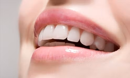 Một số trường hợp khác sau khi tẩy trắng răng thì men răng cũng có hiện tượng mất khoáng nhẹ. Có người răng bị đổi màu nghiêm trọng nhiễm sắc quá nặng.