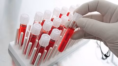 Bác sĩ sẽ không hoặc hiếm khi yêu cầu phải đi xét nghiệm máu chỉ để xem trẻ có thiếu chất, thiếu canxi, sắt, kẽm hay không trong trường hợp trẻ bình thường, trừ những trẻ còi xương, suy dinh dưỡng nặng.