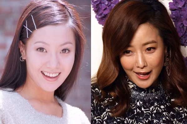 Kim Hee Sun là một trong các sao châu Á nổi tiếng vì vẻ đẹp tự nhiên, nhưng gần đây đã bộc lộ những dấu hiệu cho thấy cô lạm dụng phẫu thuật thẩm mỹ. Nụ cười méo xệch bị cho là hậu quả của việc lạm dụng chất làm đầy khiến cho khuôn cằm của người đẹp trở nên lệch lạc.