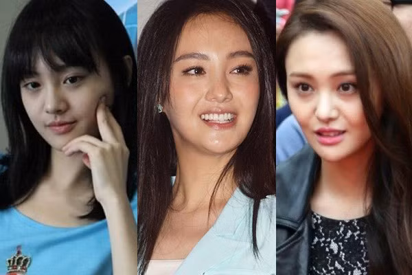 9X Trịnh Sảng từng nổi bật với nhan sắc trong sáng trong "Cùng ngắm mưa sao băng". Nhưng một năm trở lại đây, Trịnh Sảng thay đổi khá nhiều. Nữ diễn viên xinh đẹp thừa nhận cô đã đi thẩm mỹ để tìm kiếm sự thay đổi. Phần đông cư dân mạng cho rằng, sau phẫu thuật thẩm mỹ Trịnh Sảng thậm chí còn già nua và kém xinh hơn trước.