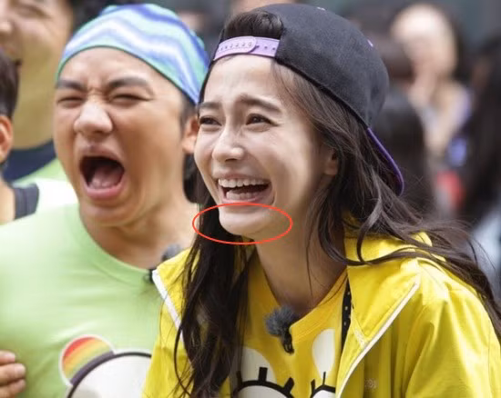 “Thiên thần” đang rất nổi của Hoa ngữ hiện nay cũng đã từng bị báo giới chỉ ra chiếc cằm nhô ra bất thường khi xuất hiện trong một chương trình. Tuy nhiên cằm của Angela Baby cũng ít lộ hơn các sao còn lại, chỉ trừ khi người đẹp cười tươi và nhìn ở góc nghiêng.