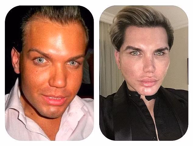 Rodrigo Alves pha nat mat vi muon lam bup be song Ken-Hinh-4