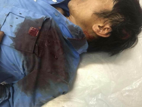 Công nhân bị nhóm côn đồ truy sát đến cùng chém gục tại chỗ (Ảnh nhân chứng cung cấp).