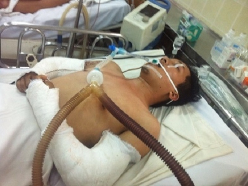 Từ khi vào showbiz, Ưng Hoàng Phúc vướng một số lùm xùm. Năm 2015, khi phim “Hùng Ali và Sáu Lóc Cóc” do nam ca sĩ đóng vai chính kiêm nhà sản xuất đang trong thời gian ghi hình, diễn viên quần chúng Nguyễn Giàu bị tai nạn, phải nhập viện. Ảnh: Vietnamnet