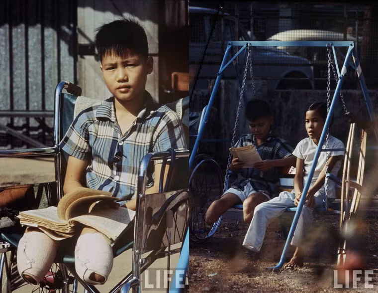 Một bé trai mất cả hai chân do dẫm phải mìn ở Sài Gòn.