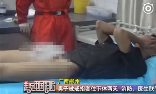 Khon kho thanh nien nghich dai deo nhan vao 