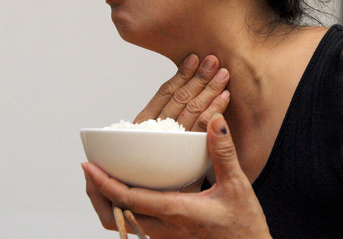 Tầm soát ung thư tuyến giáp gồm xét nghiệm TSH và siêu âm tuyến giáp. Tầm soát ung thư tuyến giáp được khuyến khích ở cả những người trẻ và lớn tuổi, đặc biệt phụ nữ.