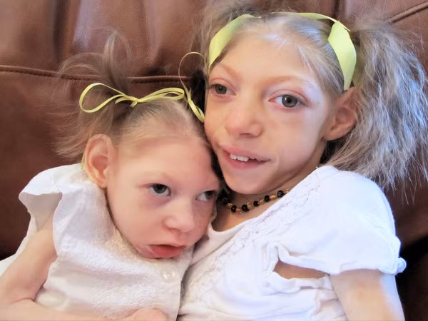 Bo Y te chi dao phong ngua virus Zika an nao nguoi-Hinh-2