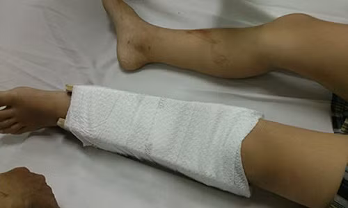 Ca gia dinh lao vao danh gãy chan nguoi yeu cua con gai