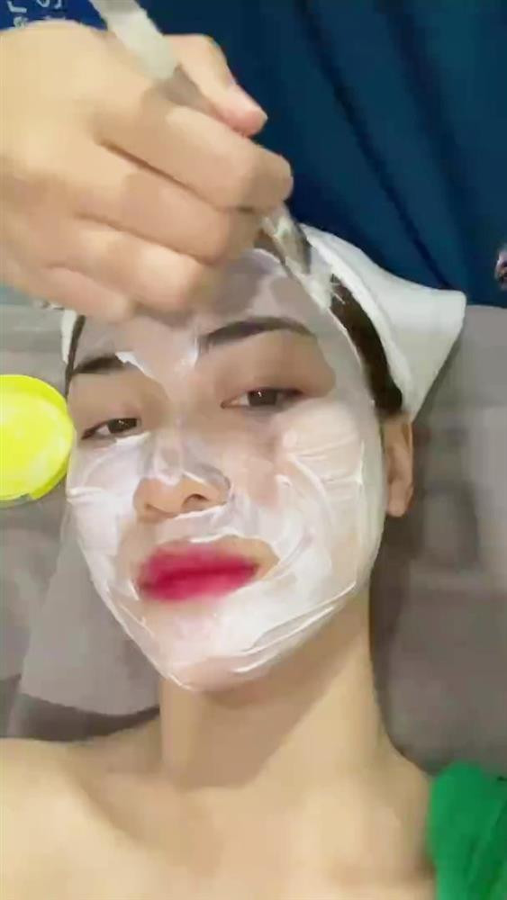 Gương mặt xinh đẹp, làn da trắng mịn màng nhưng mấy ai biết, Hoà Minzy cũng có một khuyết điểm trên gương mặt, đó là những mụn thịt gồ ghề, do tiệp màu da nên khó thấy, tuy nhiên khi trang điểm lại dễ bị bong phấn, mất thẩm mỹ. Chính vì thế, nữ ca sĩ quyết định tìm đến phương pháp bắn laser để xử lý những nốt mụn đáng ghét này. Mới đây, cô nàng cũng đã chia sẻ với khán giả cách chăm sóc làn da Sau khi xử lý bắn laser. Ảnh: Trước khi tiến hành bắn mụn thịt, nữ ca sĩ được ủ tê để giảm đau đớn.
