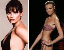 Hinh anh soc cua nguoi mau chet vi giam can-Hinh-2