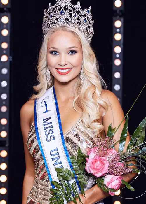 Arna Yr Jonsdottir là đại diện của Iceland tại cuộc thi Hoa hậu Hoàn vũ Thế giới năm nay. Cô từng là một vận động viên nhảy sào nữ. Năm 2016, Arna đã tham gia Hoa hậu Hòa bình Thế giới nhưng bỏ thi vì bị chủ tịch cuộc thi chê béo.