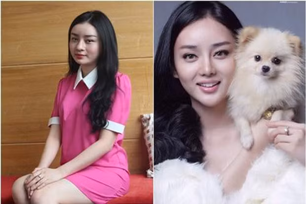 Khoảng 9/2013, hot girl Angela Minh Châu (Angela Chu, sinh năm 1991) là cái tên nhận được nhiều sự quan tâm, chú ý khi công khai quá trình "đập mặt đi xây lại".