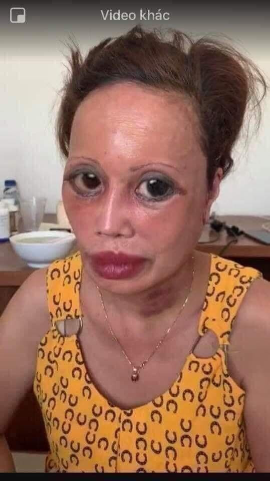 Theo đó, cô dâu 62 tuổi Cao Bằng thẳng thừng tuyên bố rằng dân tình càng ném đá thì cô càng được hưởng lợi vì chẳng khác gì ném tiền cho cô.