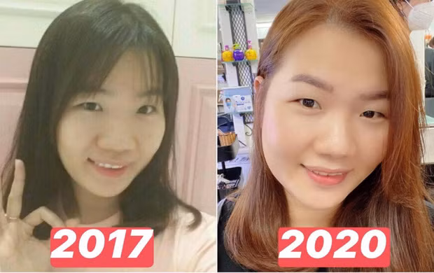 So với hình ảnh cách đây 3 năm, gương mặt của Thúy Kiều gần như "lột xác", cô nàng xinh xắn và tròn trịa hơn hẳn. Làn da của cô nàng cũng mịn màng, trắng trẻo hồng hào hơn.