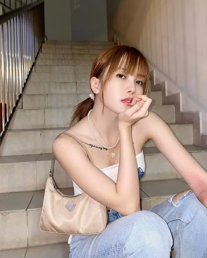 Thế nhưng thay vì chú tâm tới kiểu tóc mới này, dân chúng lại soi vào phần cánh tay đỏ ửng, sưng tấy của cô nàng.