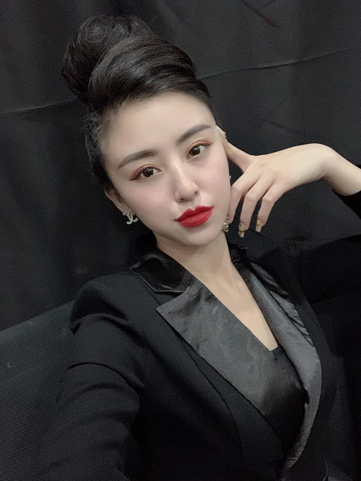 Những đường nét thay đổi trên khuôn mặt khiến cô bị cư dân mạng nghi ngờ đụng chạm "dao kéo".