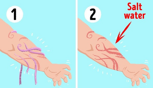 khi không may bị sứa "tấn công", bạn hãy làm sạch vết thương và loại bỏ phần còn lại của xúc tu sứa, rửa sạch vết thương bằng nước muối. Để loại bỏ độc tố, bạn hãy dùng giấm táo, hoặc rượu bôi lên vết thương rồi tới gặp bác sĩ để được tư vấn, trợ giúp.