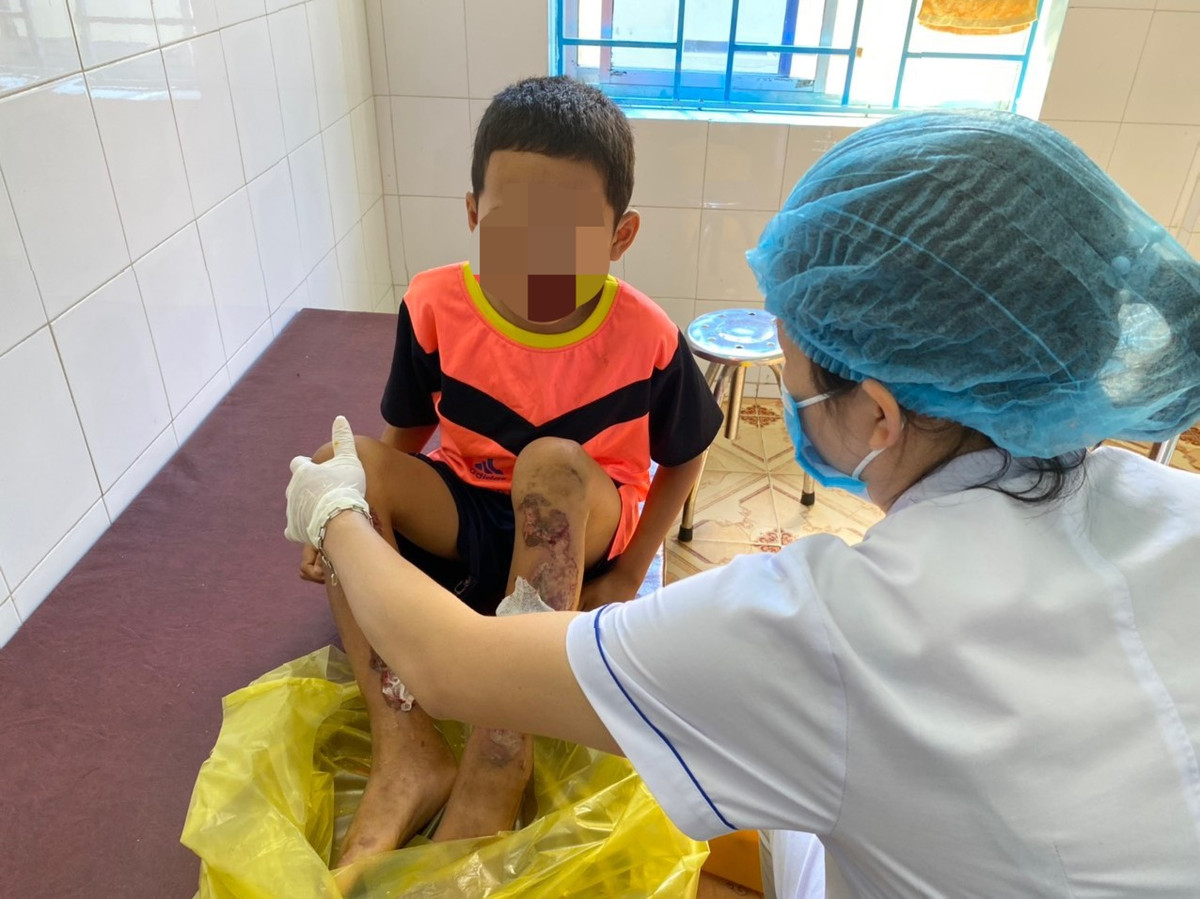 Sức khỏe cháu bé bị bố bạo hành ở Quảng Bình hiện ra sao? Suc khoe chau be bi bo bao hanh o Quang Binh hien ra sao?