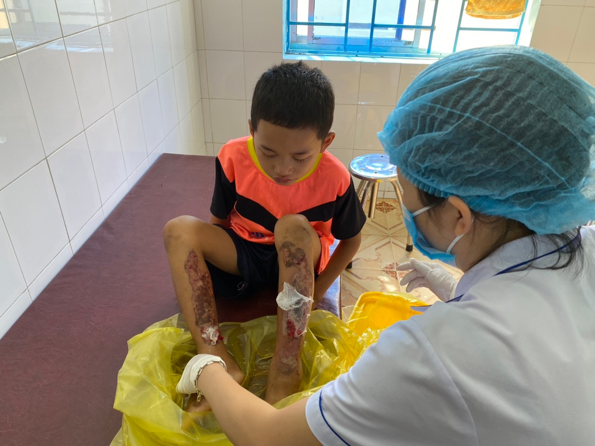 Tieng khoc xe long cua chau be bi bo tam xang dot chan-Hinh-2