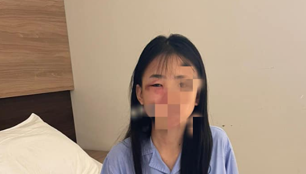 Ha Noi: Nu sinh lop 8 nghi bi danh hoi dong den nhap vien