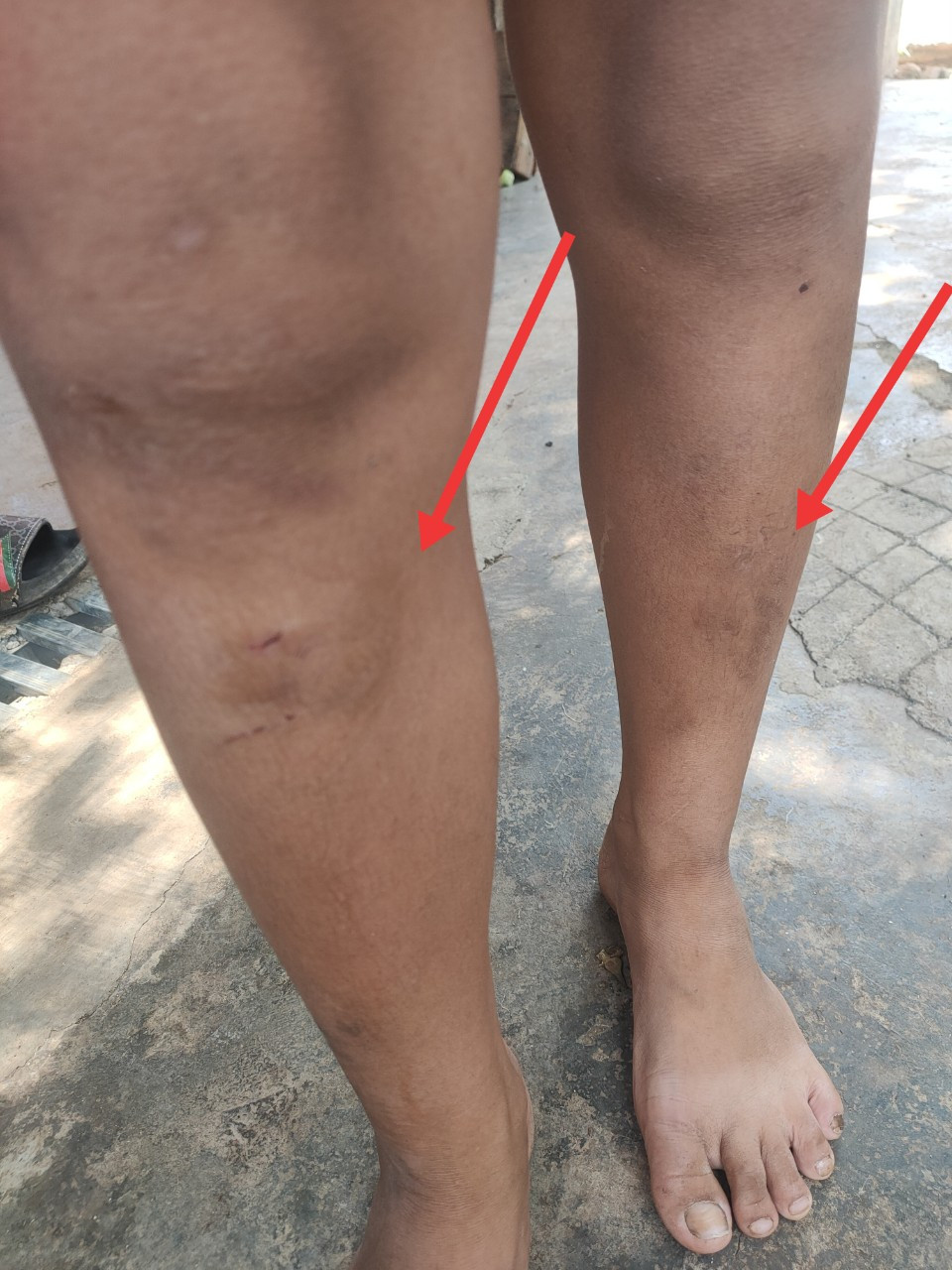 Chuyển hồ sơ xử lý vụ 5 cháu nhỏ bị hàng xóm đánh - Hình 2 Chuyen ho so xu ly vu 5 chau nho bi hang xom danh-Hinh-2