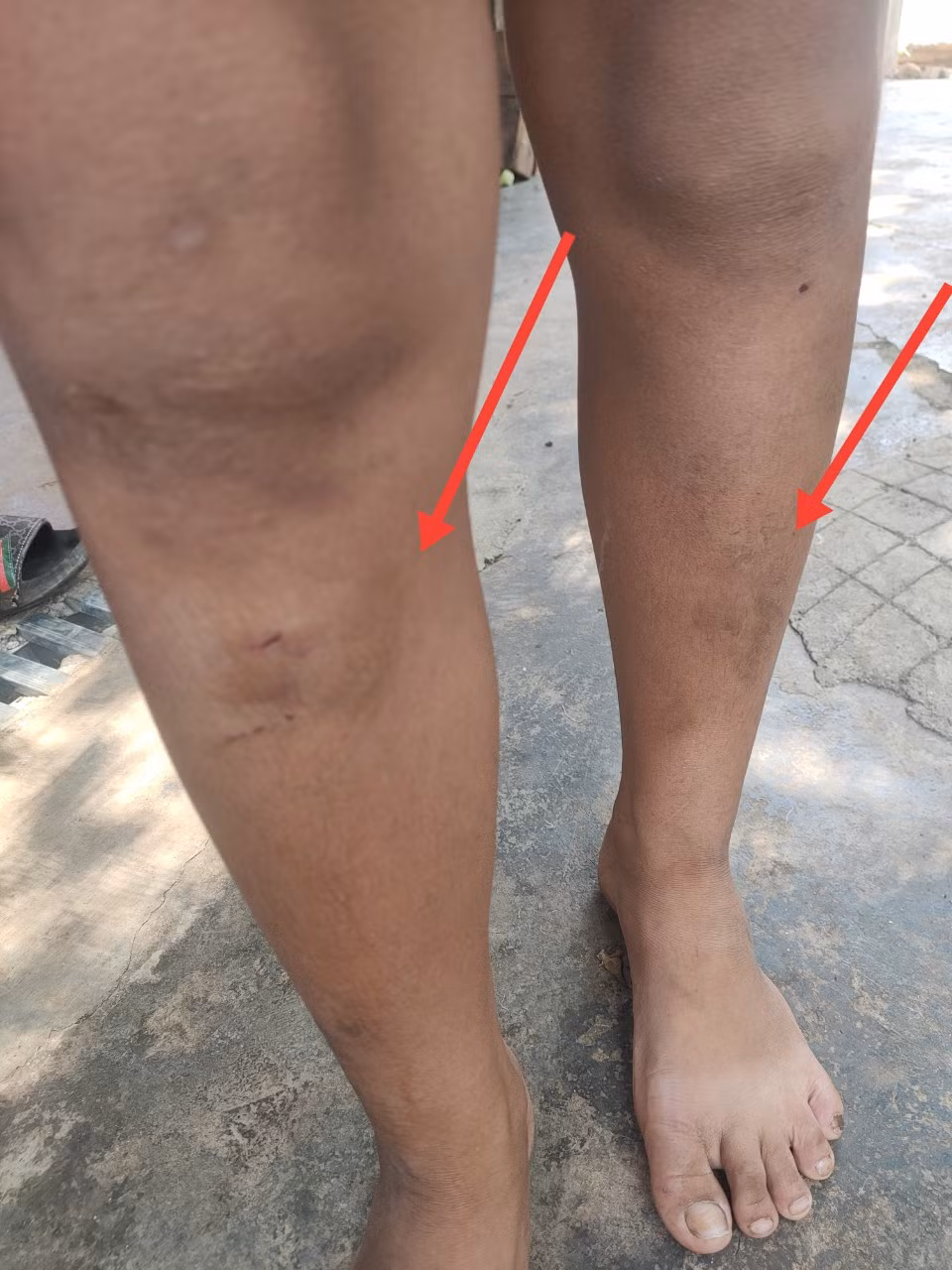 Chuyển hồ sơ xử lý vụ 5 cháu nhỏ bị hàng xóm đánh - Hình 2 Chuyen ho so xu ly vu 5 chau nho bi hang xom danh-Hinh-2